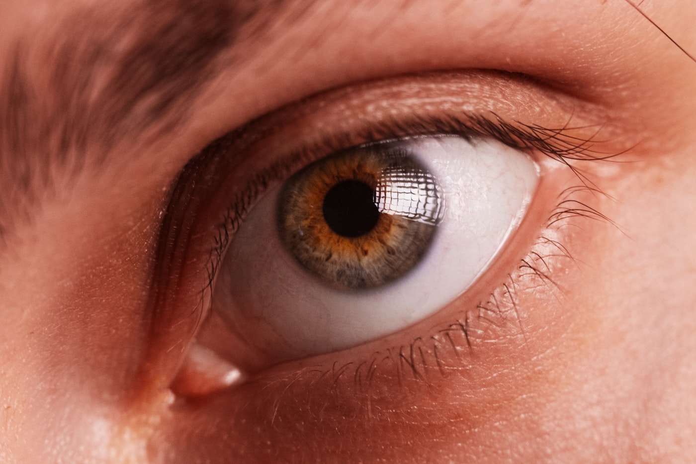 Dry Eye Clinic