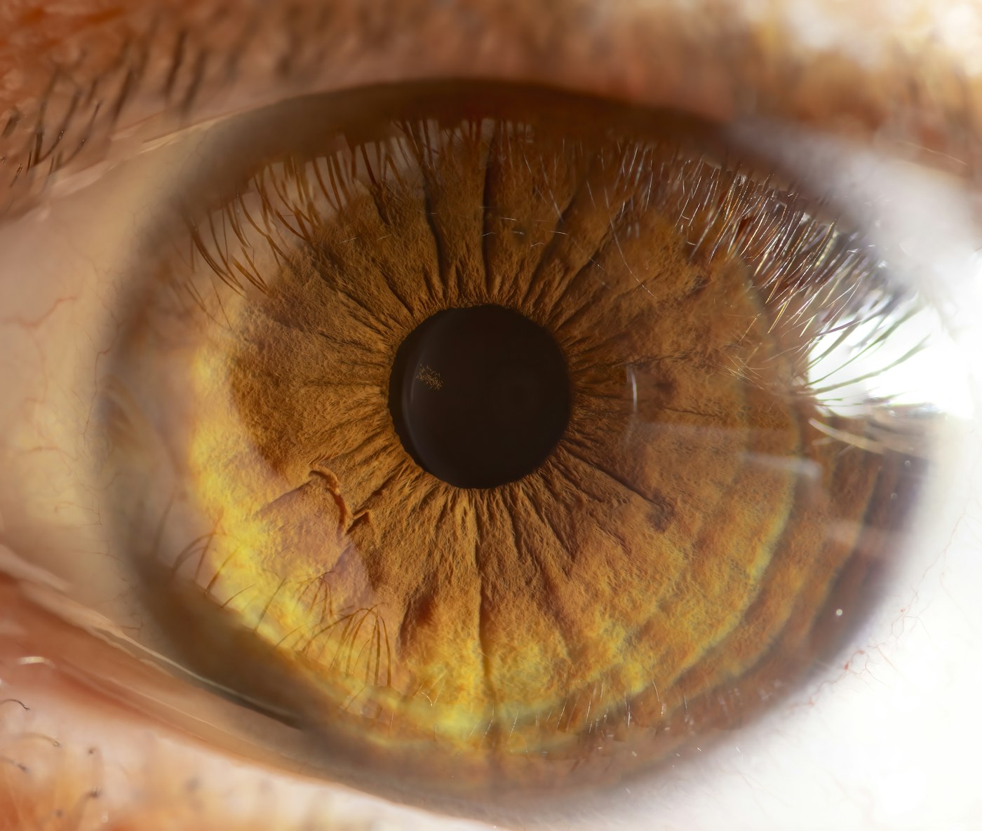 Retina & Diabetic Eye